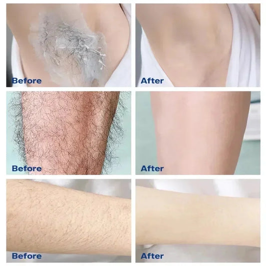 Fast Hair Removal Cream Painless Hair Growth Inhibitor Arm Armpit Legs Permanent Depilatory for Men Women Beauty Body Care 50g