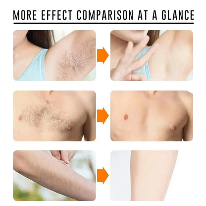 Fast Hair Removal Cream Painless Hair Growth Inhibitor Arm Armpit Legs Permanent Depilatory for Men Women Beauty Body Care 50g