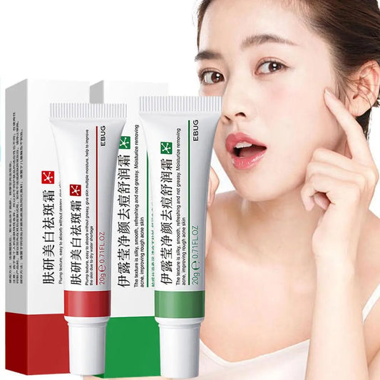 EBUG Skin Care Duo - 20g Whitening Dark Spot Cream + 20g Acne Removal Cream Hydrating Brightening Soothing Facial Care Set