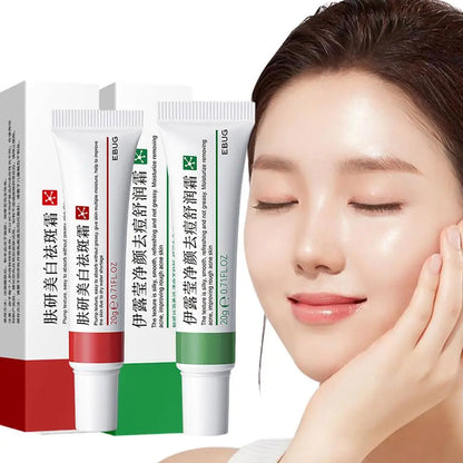 EBUG Skin Care Duo - 20g Whitening Dark Spot Cream + 20g Acne Removal Cream Hydrating Brightening Soothing Facial Care Set